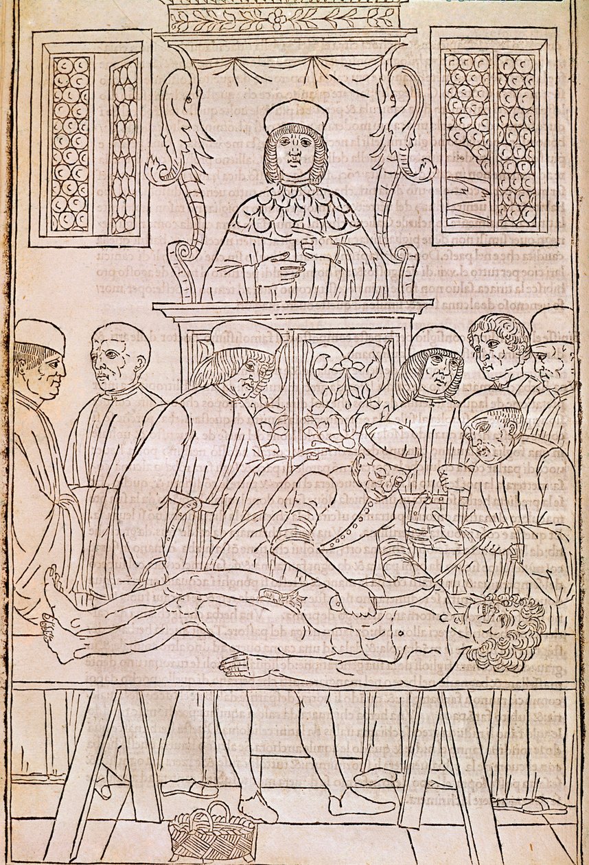 Pitva. Codice. Tělo mrtvého muže pitvají lékaři pro studii anatomie. "" Fasciculus Medicinae ". Kodex lékařského svazku od Johannese Kethana od Unknown artist