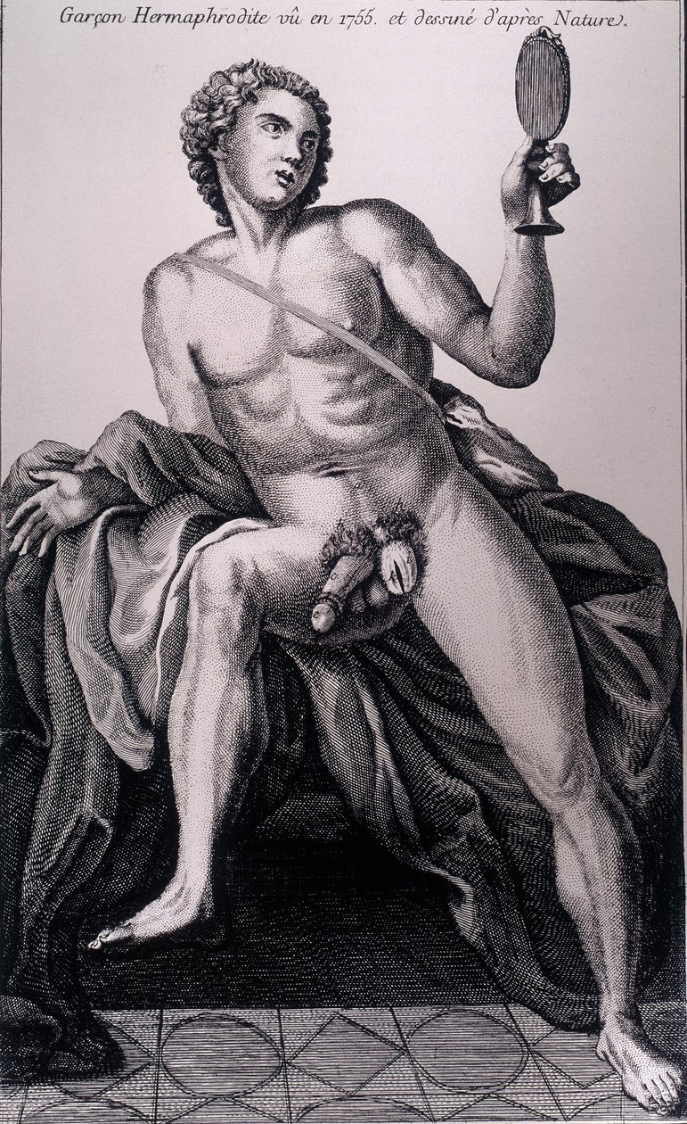 Hermafroditní chlapec viděný v roce 1755 a čerpaný z přírody. od Unknown artist