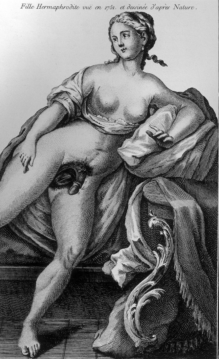 Hermafroditní dívka viděná v roce 1751 a čerpaná z přírody. od Unknown artist