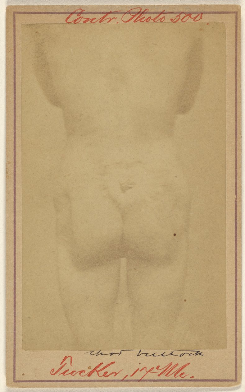 [Jno. E. Tucker, postřelený do hýždí, oběť občanské války] od Unknown artist