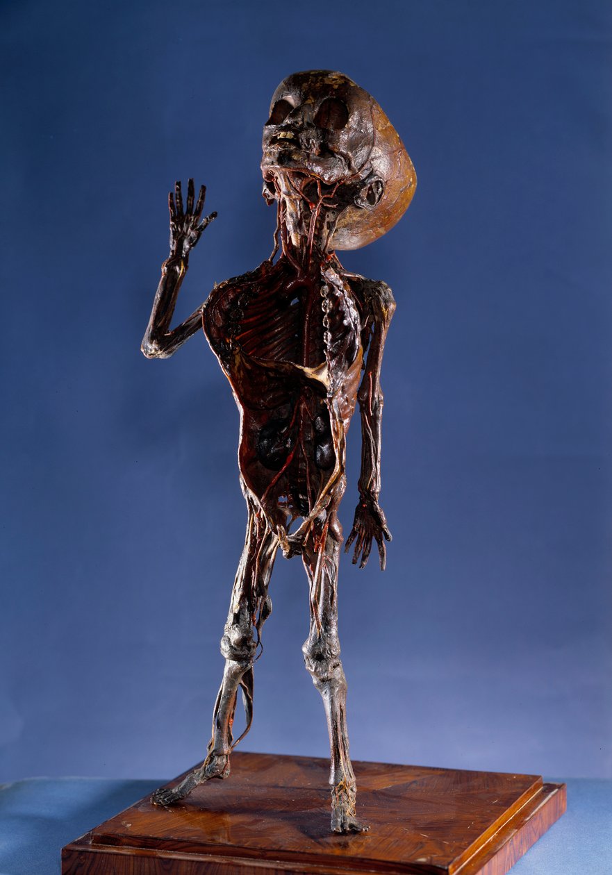 Medicína: loupaná figurka. Soukromá sbírka z 18. století od Unknown artist