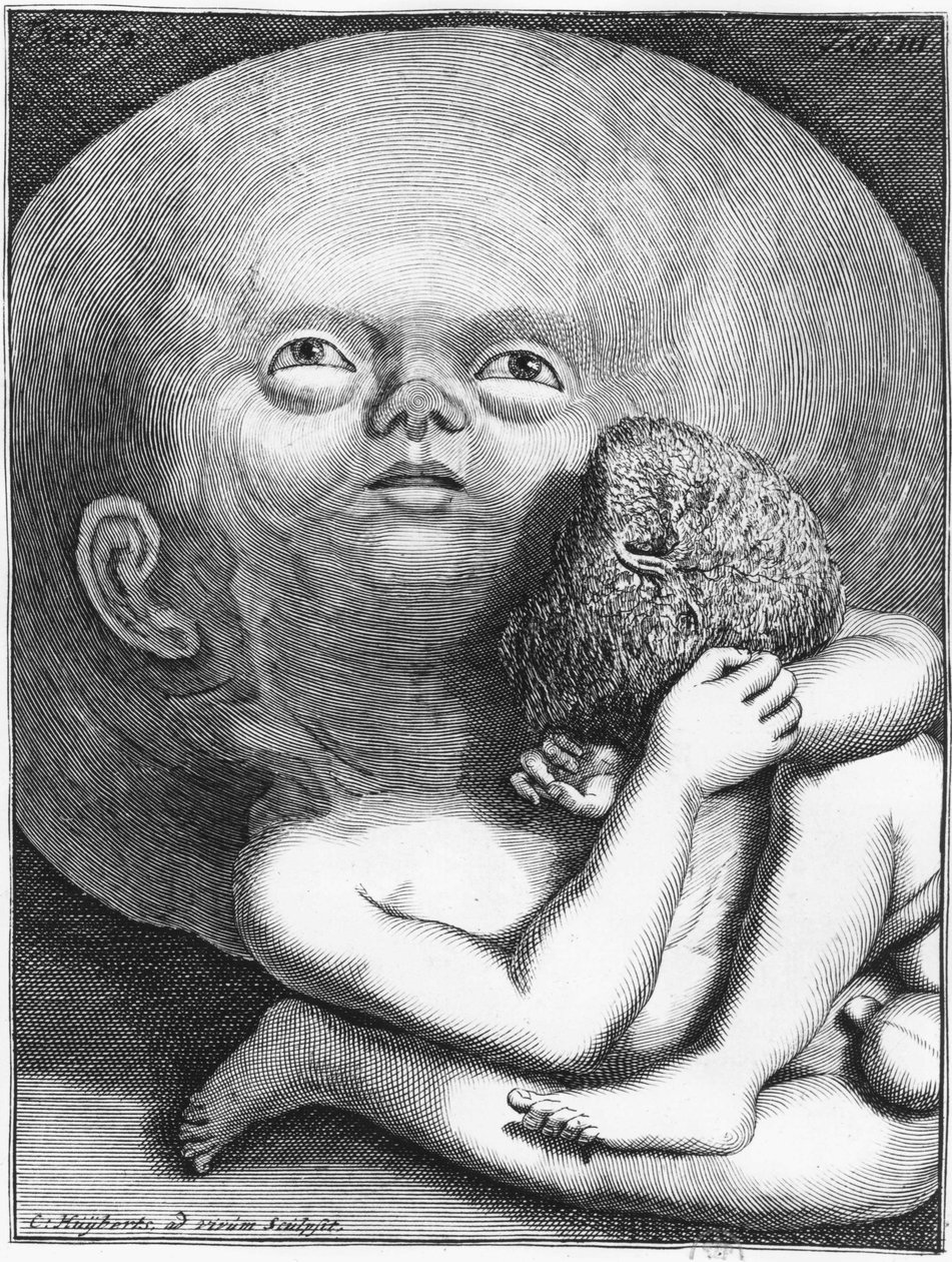Monster: Child hydrocephalus anthropology - grave., an.n.d., pozdní 18. stol. od Unknown artist