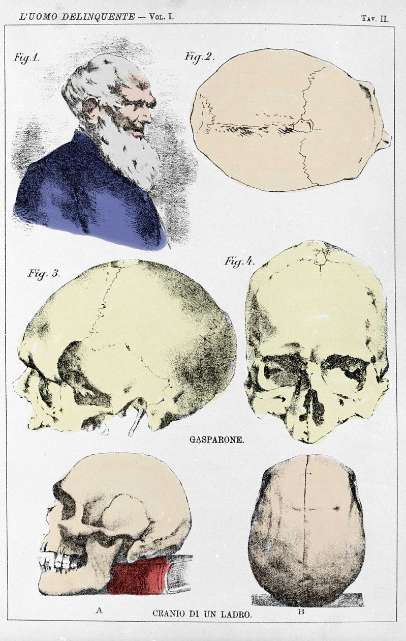 Studie o morfologii delikventní lebky od italského kriminologa od Unknown artist