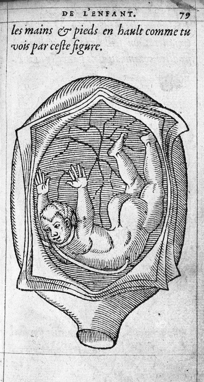 Poloha plodu v děloze během těhotenství. Rytina z „“De la generation des enfants““ od francouzského lékaře a chirurga Ambroise Pare (1509-1590) 16. století od Unknown artist