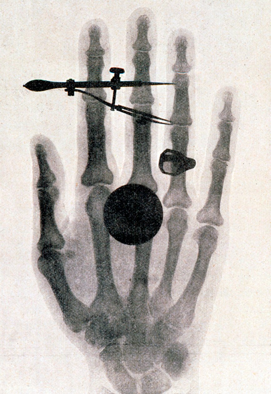 Rentgenová fotografie ruky jeho manželky Wilhelma Roentgena, 1896 od Wilhelm Conrad Rontgen