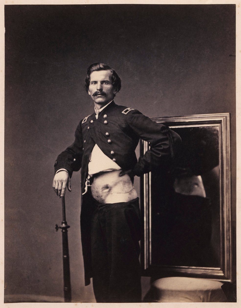 Major H. A. Barnum, Zotavení po průstřelu břicha s perforací levého ilu, z fotografického katalogu chirurgické sekce od William Bell
