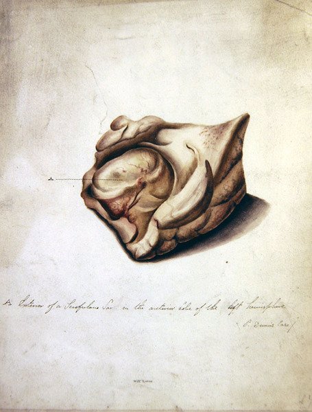 Studie mozku II, asi 1850 (akvarel na papíře) od William Lover