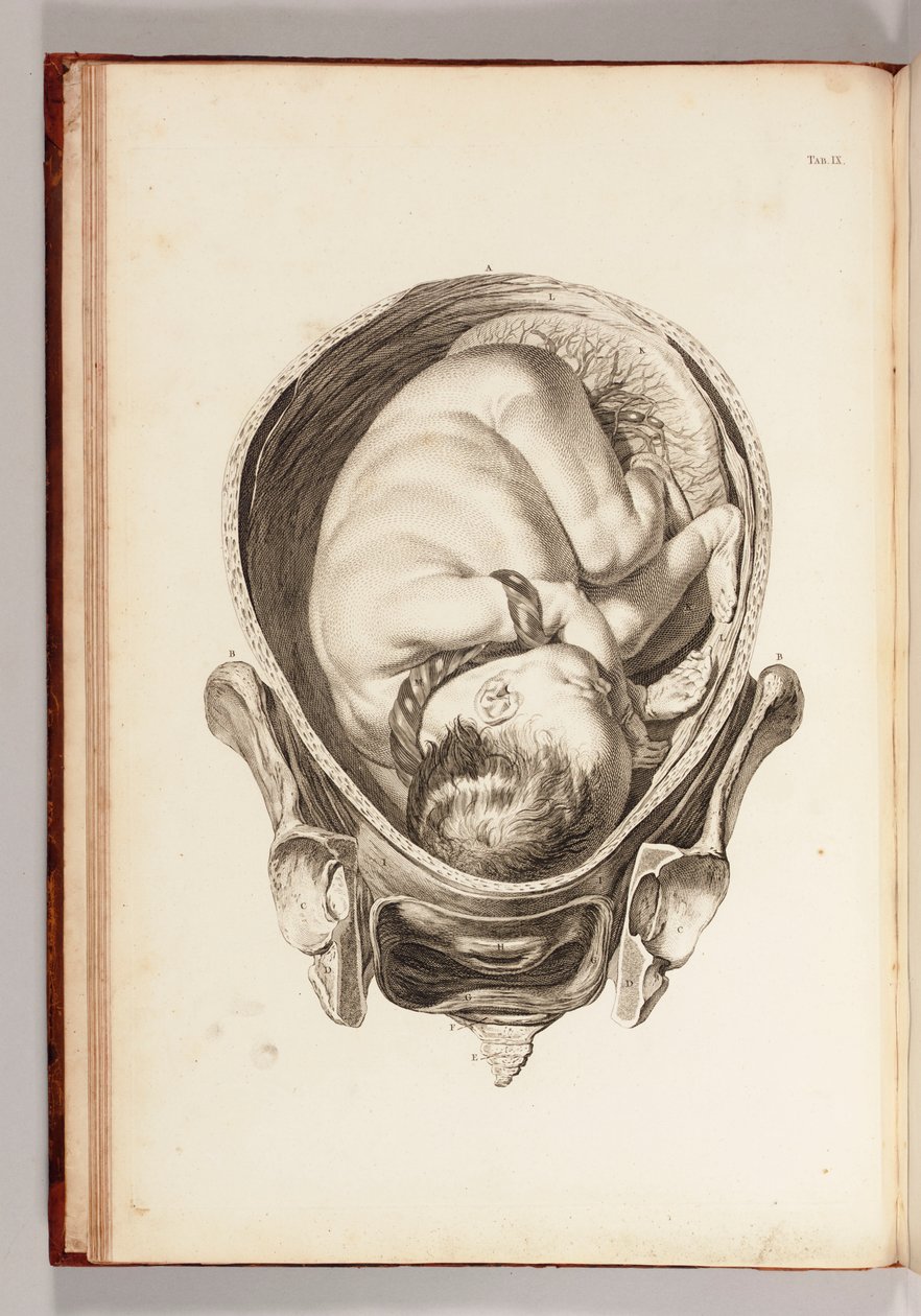 Rytina dítěte v lůně ze „Souboru anatomických tabulek, s vysvětlivkami a zkrácením praxe porodní asistence“, 1754 od William Smellie