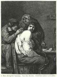 Operace zad od Adriaen (after) Brouwer