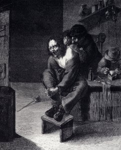 Chirurgická operace Rytina podle obrazu Adriena Brauwera (dělal 1608) 17. stol. od Adriaen (after) Brouwer