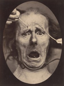 Electro-Physiologie, Obrázek 64, 1854-56, vytištěno 1862.
