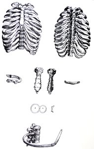Desky z první knihy De Humani Corporis Fabrica od Andreas Vesalius
