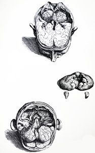 Desky ze sedmé knihy De Humani Corporis Fabrica od Andreas Vesalius