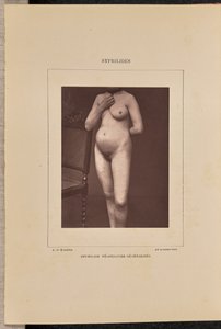 Generalizovaná vezikulární syfilis od Arthur de Montmeja