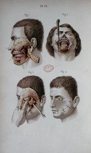 Anatomická deska horní čelisti od C and Huette E. Bernard