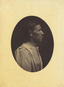 Portrét muže, 42 let, ohromeného nadměrným pitím alkoholu..., 1854-1856, z profilu.