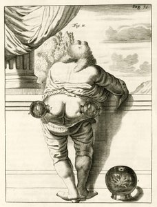 Příklad baňkování z The Practice of Medicine od Frederika Dekkerse, 1694 od Dutch School