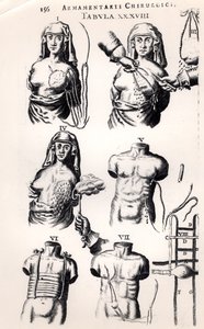 Operace rakoviny prsu, od Armamentarii Chirurgici od Johannese Schultese (1595-1645), publikované v Amsterdamu, 1672 od Dutch School