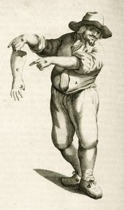 Odstranění odumřelé kůže s pustulami, z Praktických cvičení týkajících se léčebné metody Frederik Dekkers, 1694 od Dutch School