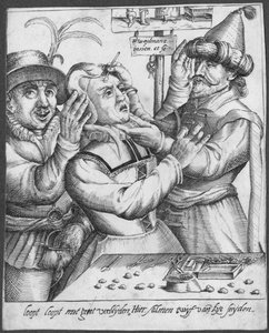 Trepanning, rytina H. Weydmanse (16. století) od Dutch School