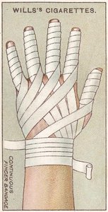 Nepřetržitá bandáž prstů, č. 48 ze série karet Willss Cigarettes First Aid, 1913 od English School