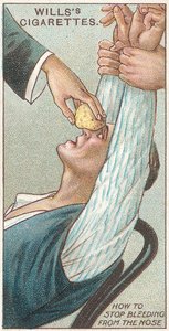 How to Stop Bleeding from the Nos, no.31 ze série First Aid of Willss Cigarettes cards, 1913 od English School
