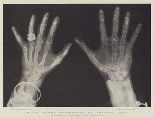 Royal Hands reprodukované Rontgen Rays (rytina) od English School