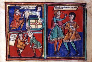 Sloane Ms 1975 fol.93 Lékařské operace od English School