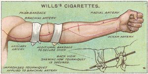 Turniket, č. 11 ze série karet Willss Cigarettes First Aid, 1913 od English School