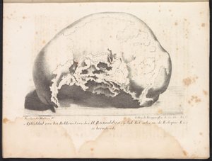 Lebka svatého Rumbolda, 1825 Zobrazení pánve sv. Rumolda tak, jak je v Reliquie-Kas rezignováno (název na objektu)