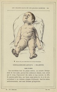 Postoj malého dítěte s eklamptickými křečemi (barevné lito) od French School
