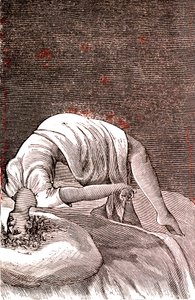Hysteria, henkinen ja hermoston häiriö, joka johtuu voimakkaasta ahdistuksesta. 1887 (kaiverrus) od French School