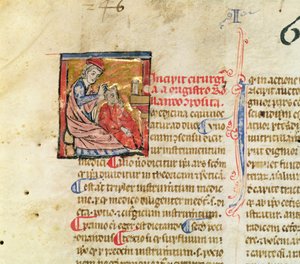 paní Lat. 7134 fol. 1 Trepanation, od Chirugie de Maitre Rolandi od French School