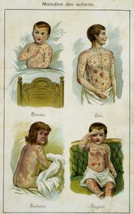 Deska znázorňující dětská onemocnění: kopřivka, svrab, spála a spalničky (léky z Bilzu, přírodní léčba) konec 19. století. od French School