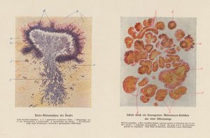Actinomyces bovis (barevná litografie) od German School