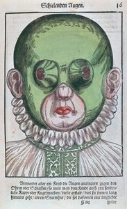 Maska na léčbu šilhání, z Ophthalmodouleia od Georga Bartische (1535-1636), vydaná v Drážďanech v roce 1583 (barevný dřevořez) od German School