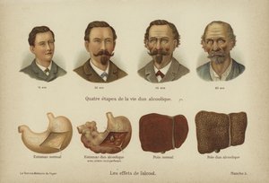 Účinky zneužívání alkoholu (color litho) od German School