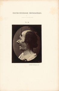 Fotografická elektrofyziologie, obrázek 39 od Guillaume Benjamin Duchenne