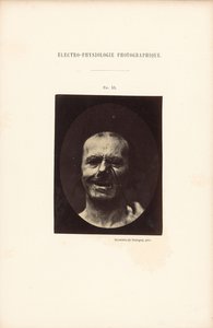 Fotografická elektrofyziologie, obrázek 53 od Guillaume Benjamin Duchenne
