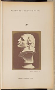 Obr. 66 od Guillaume Benjamin Duchenne