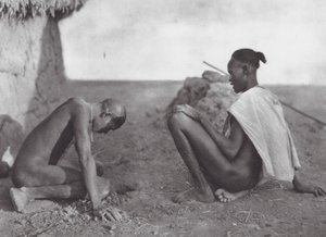 Afrika: Lékař krvácí pacientovi (čb fotografie) od Hugo Adolf Bernatzik