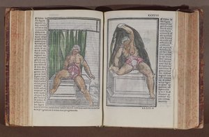 Ženská anatomie, z komentářů k světové anatomii s nejvelkolepějšími doplňky, Jacopo Berengario da Carpi (asi 1460-asi 1530), publikovaná v Bologni, 1521 (barevný dřevořez) od Italian School
