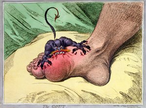The Gout, vydané Hannah Humphrey v roce 1799 (ručně kolorovaný měkký lept)