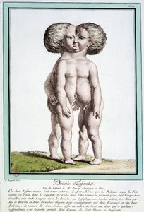 Siamské děti - v „“Odchylky přírody““ od Régnaulta od Jean Baptiste Regnault