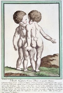 Siamské děti - v „“Les divisions de la nature““ od Régnaulta od Jean Baptiste Regnault