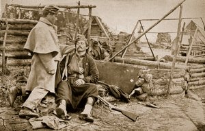 Zraněný Zouave, 1861-65 od Mathew B. Brady