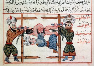 Redukce zlomeniny. Miniatura z pochoutky turecké medicíny od Sharaf al-dina od Ottoman School