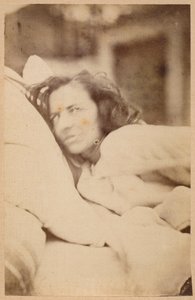 Hysterická epilepsie, delirium, chtíč, deska XXXVI z „Iconographie Photographique de La Salpetriere“ od Bourneville a P. Regnarda, Paříž, 1876 (tisk alba)