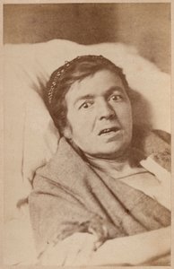 Hysterická epilepsie, kontrakce obličeje, deska VIII z „Iconographie Photographique de La Salpetriere“ od Bourneville a P. Regnarda, Paříž, 1876 (tisk alba) od Paul Regnard