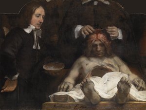Lekce anatomie Dr. Jana Deymana, 1656 od Rembrandt van Rijn